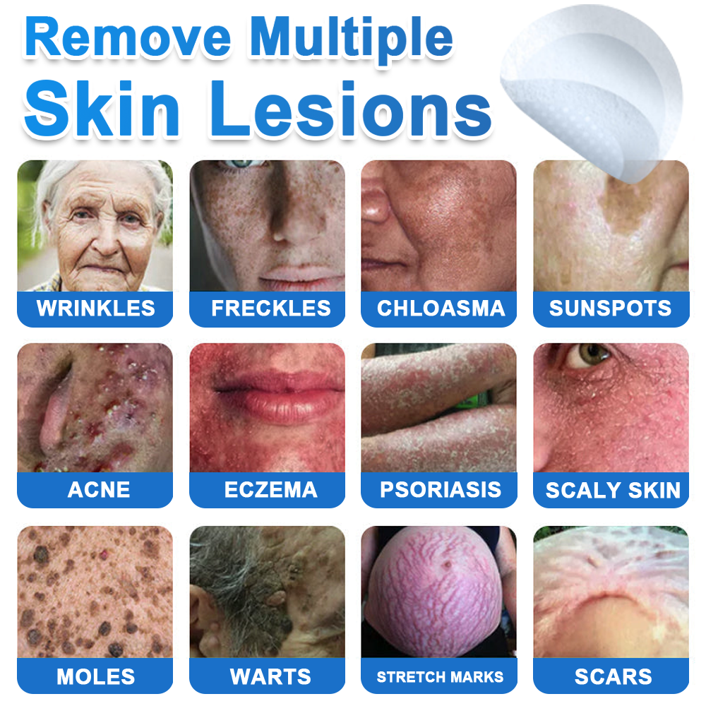2-in-1 Microneedle & Hydrocolloid Patch | Raised Moles,Acne,  Flat Warts & Skin Tags Remover | Improves Wrinkles, Scars & Blemishes | Invisible Star Pimple Patches for Face & Body