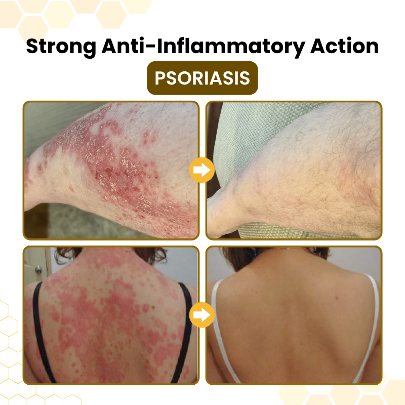 Bee Venom Skin-Restoration Cream
