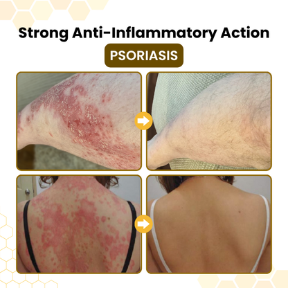 Bee Venom Skin-Restoration Cream